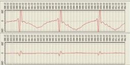 Вихретоковый многоканальный дефектоскоп ВД-132-К-IIIY-ОКО-01