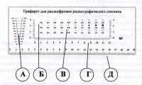 Трафарет для расшифровки радиографических снимков (мерный шаблон).